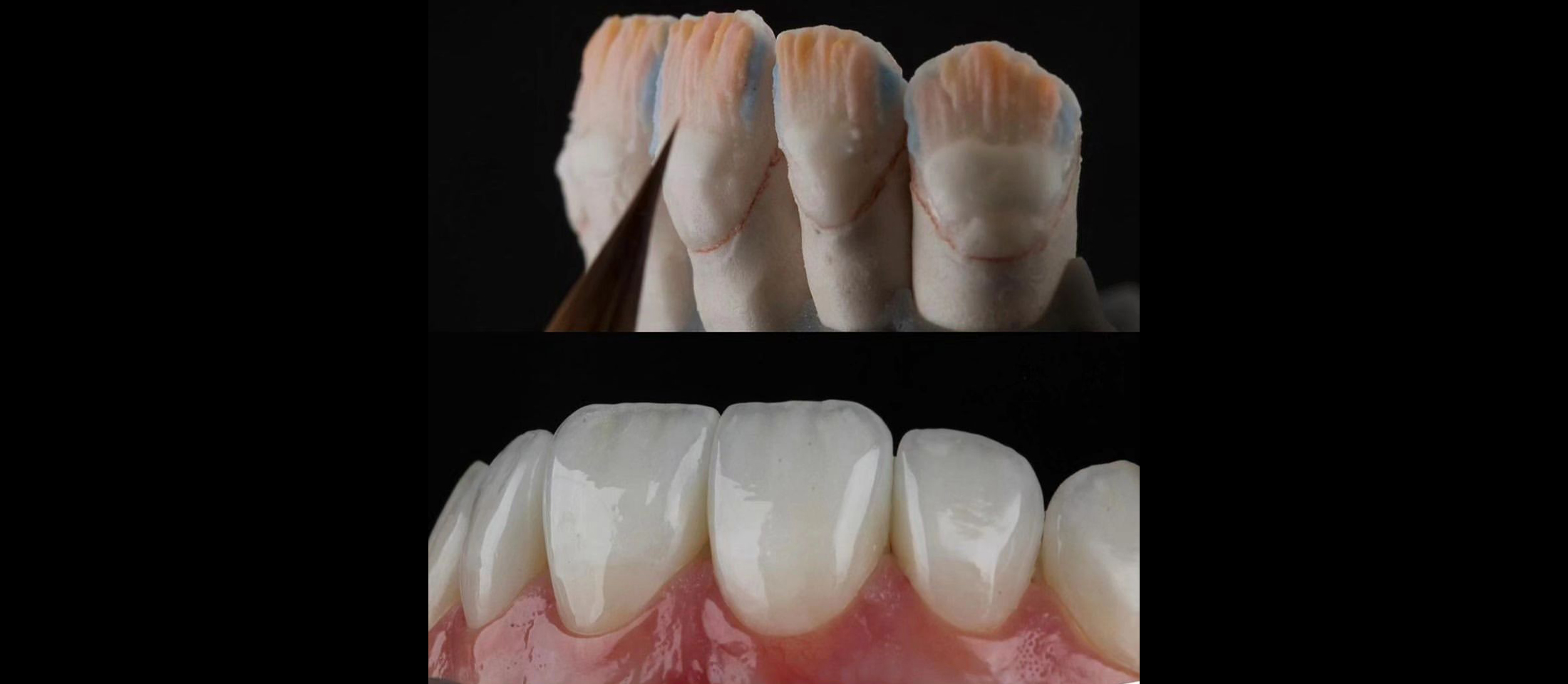 Ceramic photo--Zeta Dental Lab