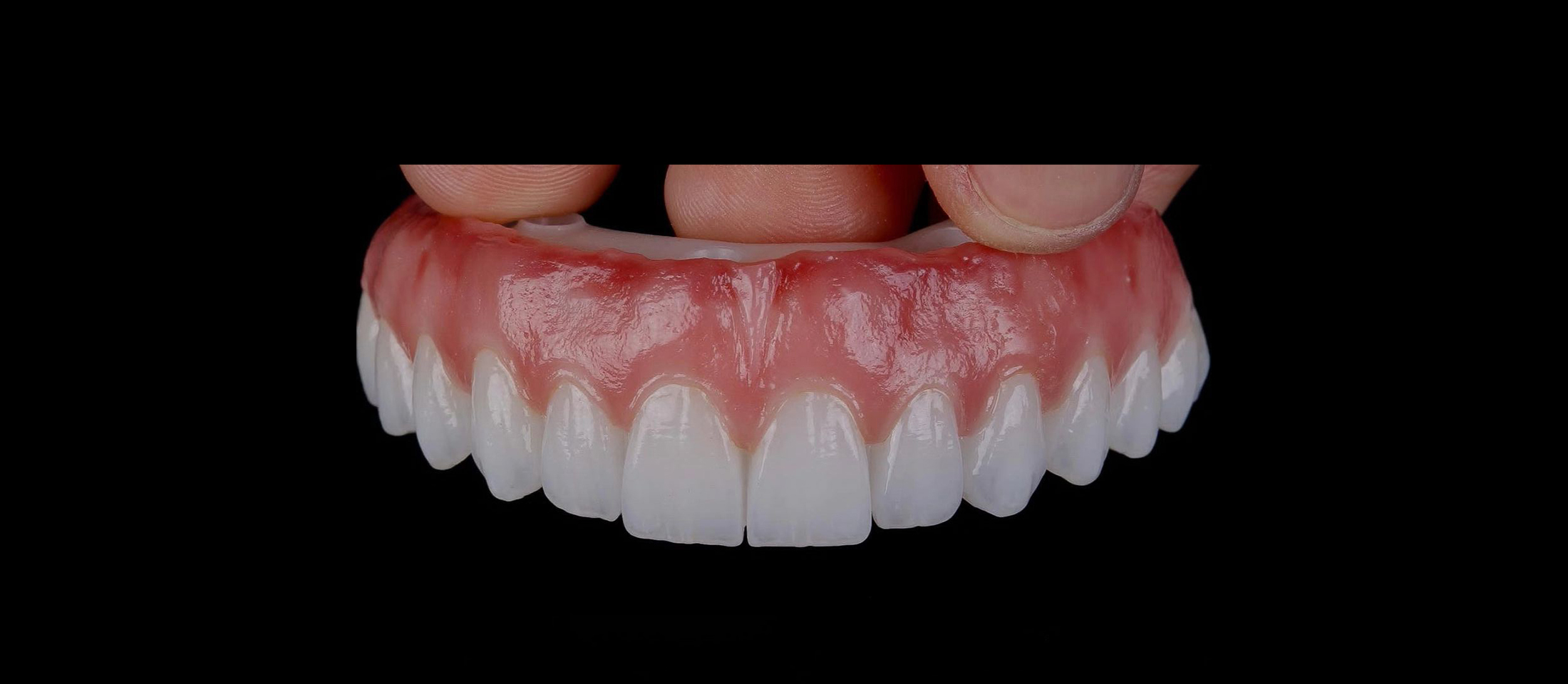 Full Arch Zirconia bridge--Zeta Dental Lab